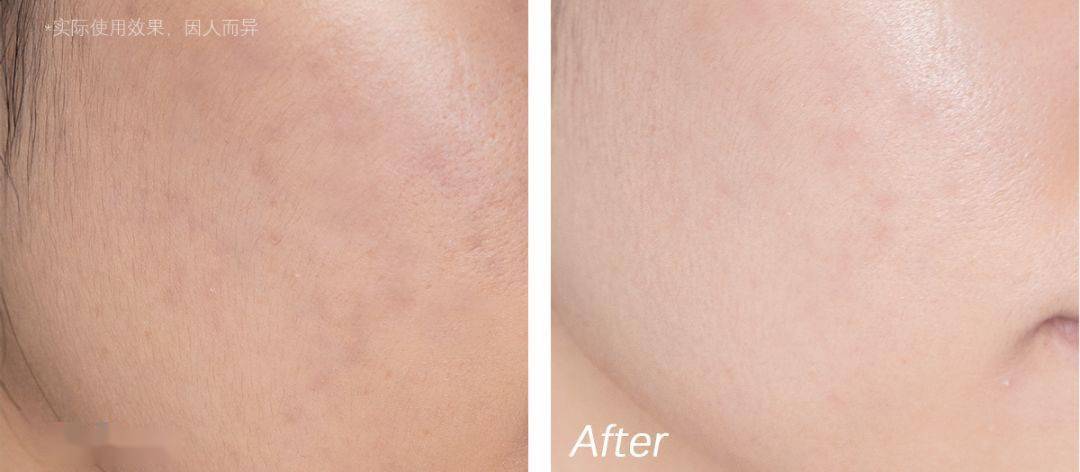 黑头|沈梦辰没骗我！HFP这些宝藏单品，真的让我“一夜换脸”！