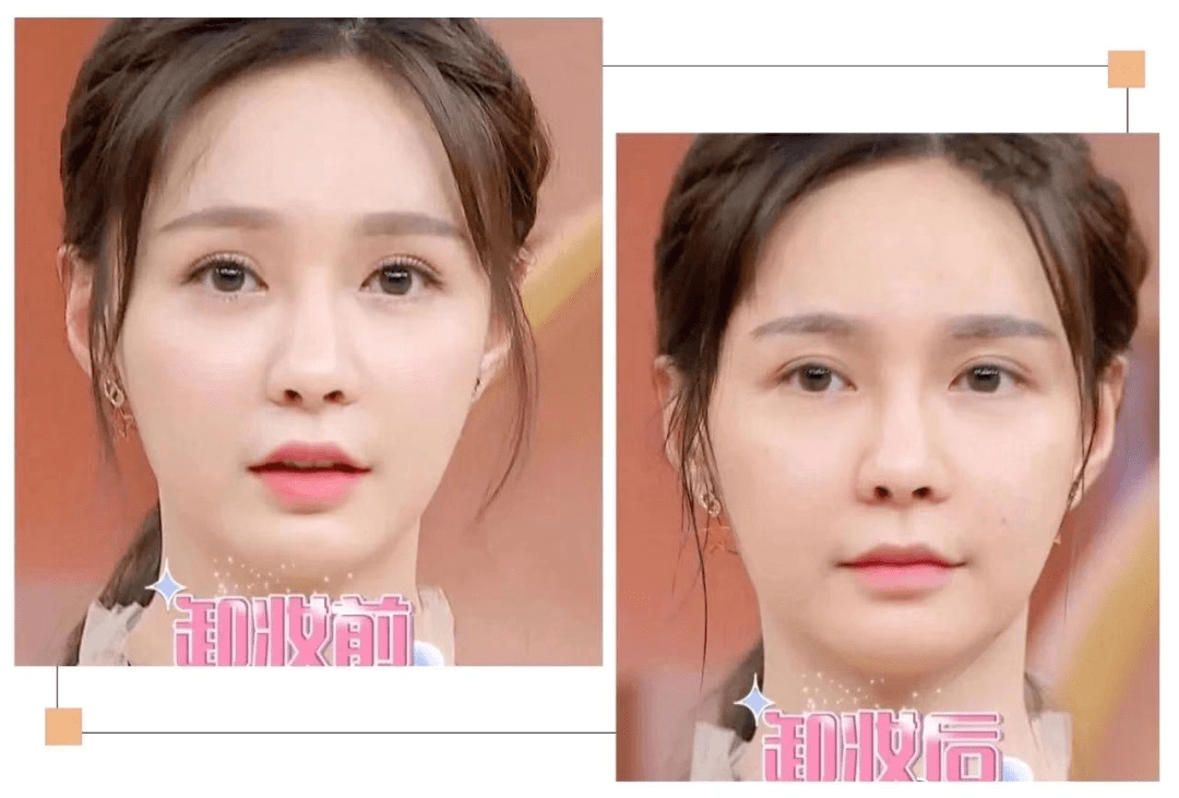 黑头|沈梦辰没骗我！HFP这些宝藏单品，真的让我“一夜换脸”！