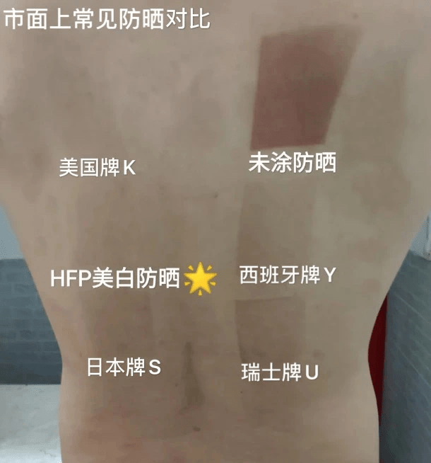 黑头|沈梦辰没骗我！HFP这些宝藏单品，真的让我“一夜换脸”！