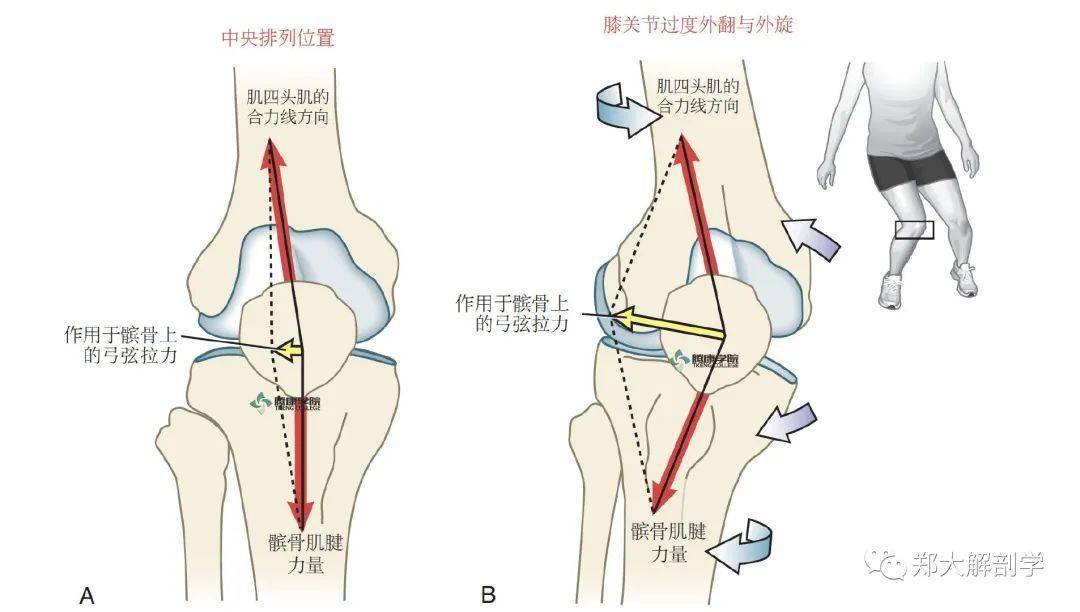 67髌股关节疼痛综合征_髌骨