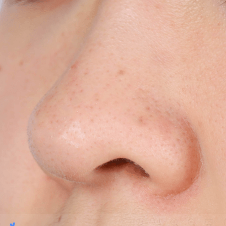 皮肤|纯分享：我最爱的11款小众面膜都在这了！