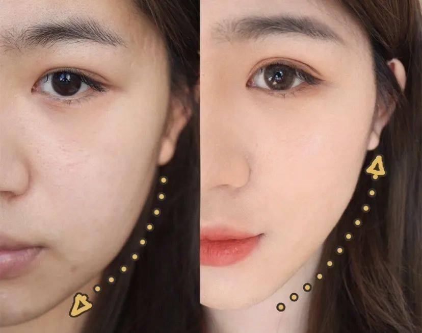 效果|这个比瘦脸针还好用的好物，既消水肿又提拉紧致，立变小V脸！