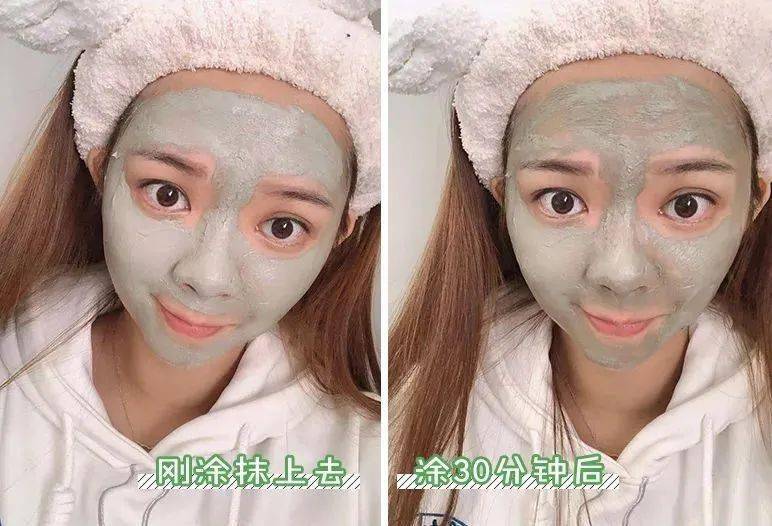 吸铁石|新西兰百年历史“污垢吸铁石”,15分钟告别黑头、粉刺、闭口!