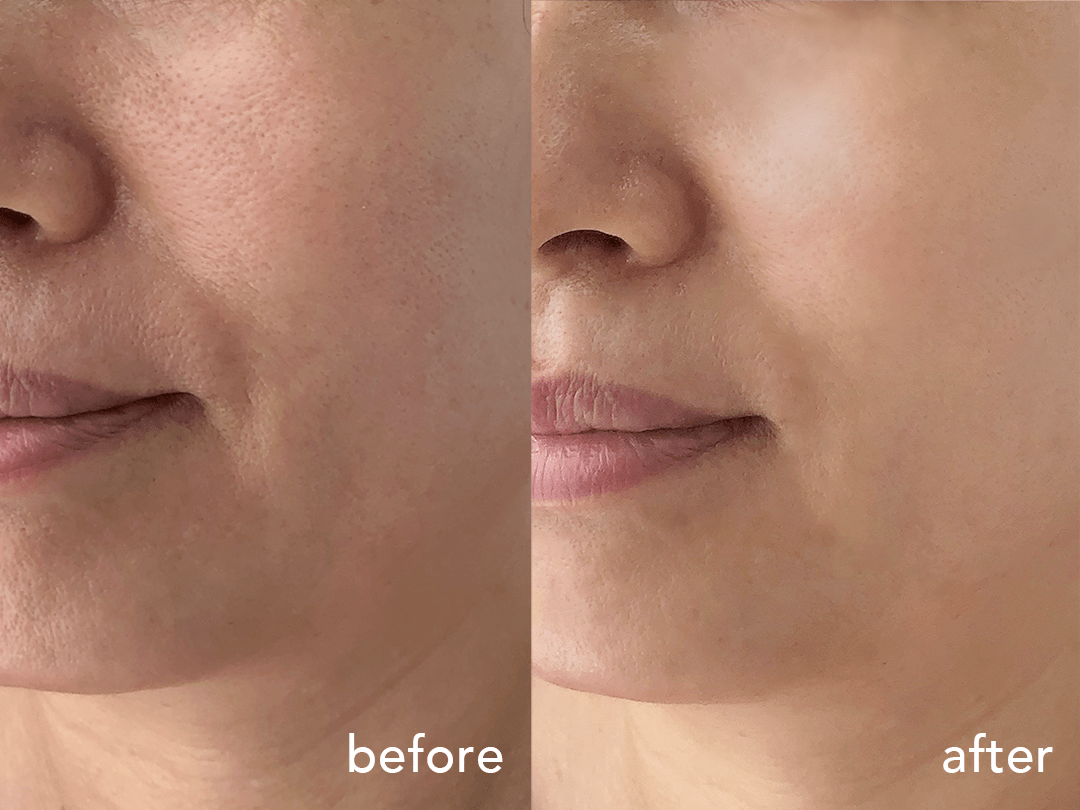 肌肤|50岁钟丽缇干了啥？！迷倒小12岁奶狗，不老神术教教我…