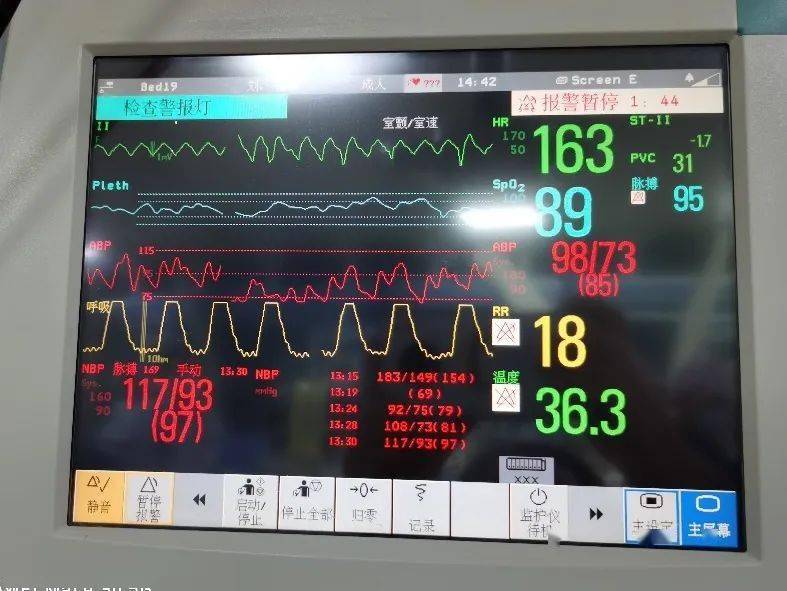 将病人转运至ccu(心脏重症病房) 进一步抢救  心电监护,动态血压监测