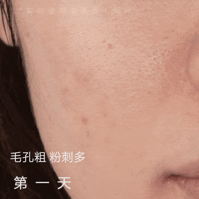 毛孔|鼻子脏到挤出“白条条”?照我这样做,脸上啥脏东西都溶掉!
