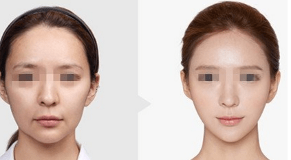 集体|比发福更可怕，人到中年为何集体“发腮”？