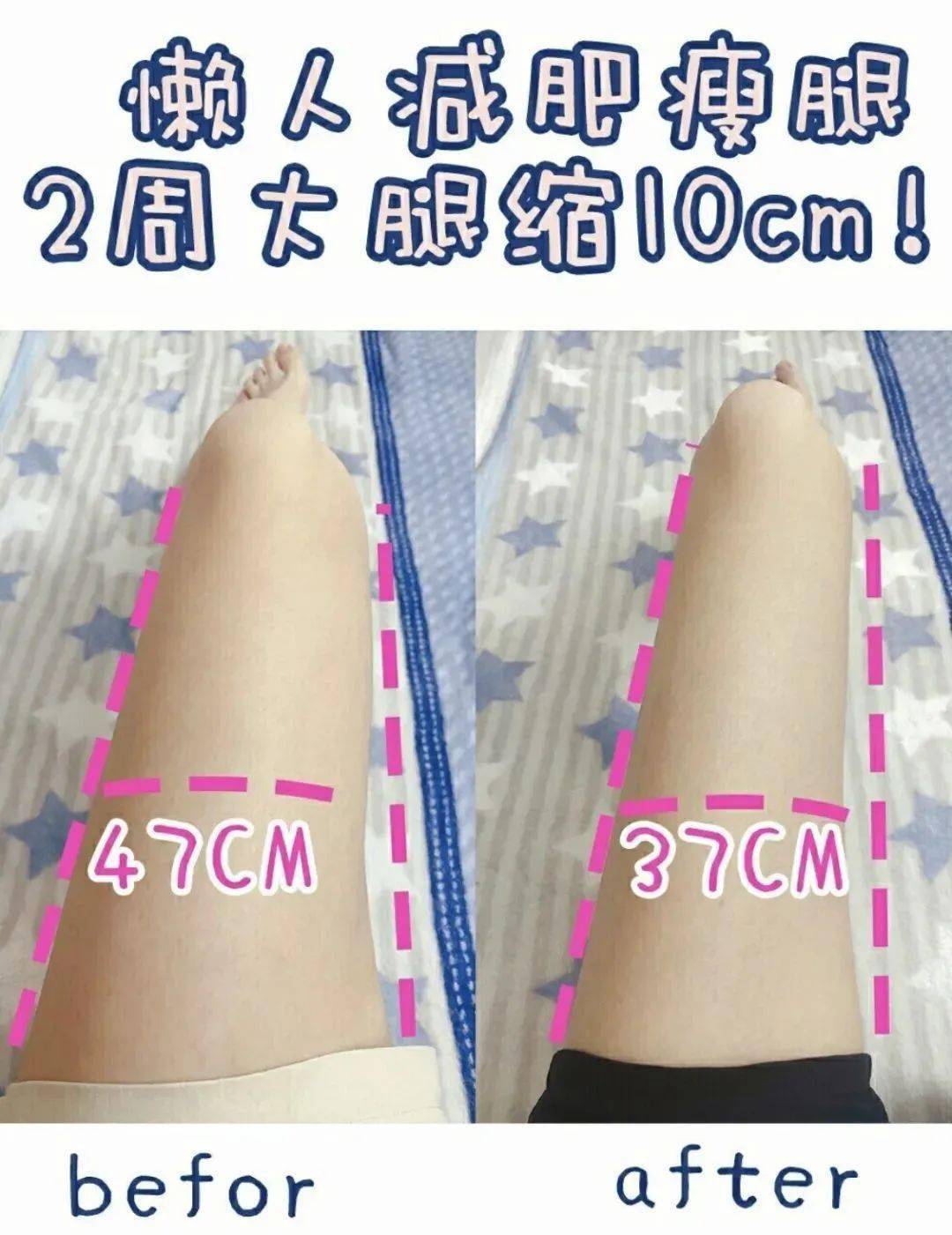 运动|吴昕被曝领证结婚啦？经历“换头”变美后人生果然能开挂！