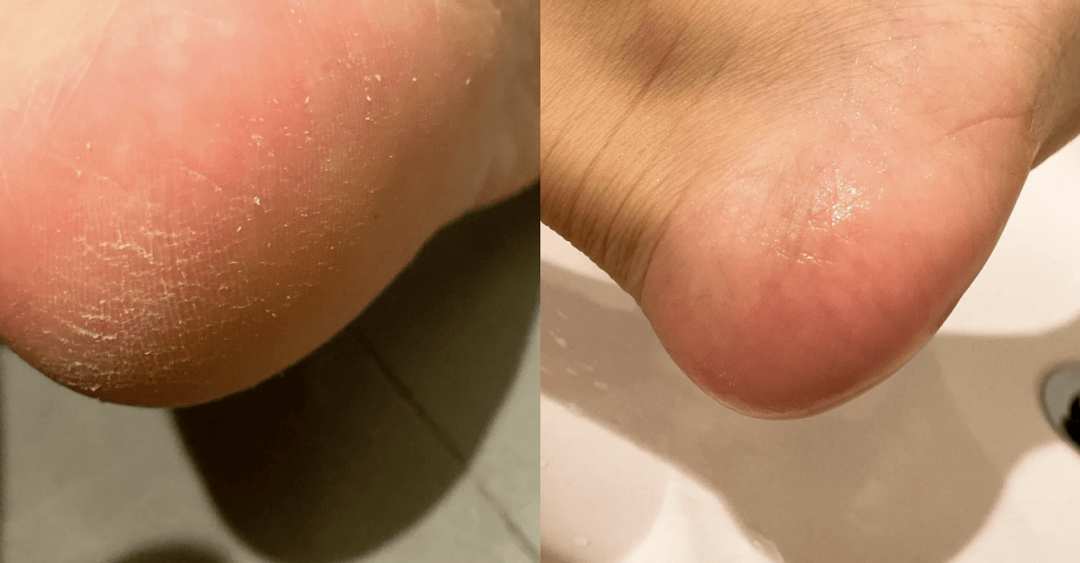 角质|薇娅吹爆的这款磨砂膏,我替你们试了,用完蚊子能在背上劈叉!