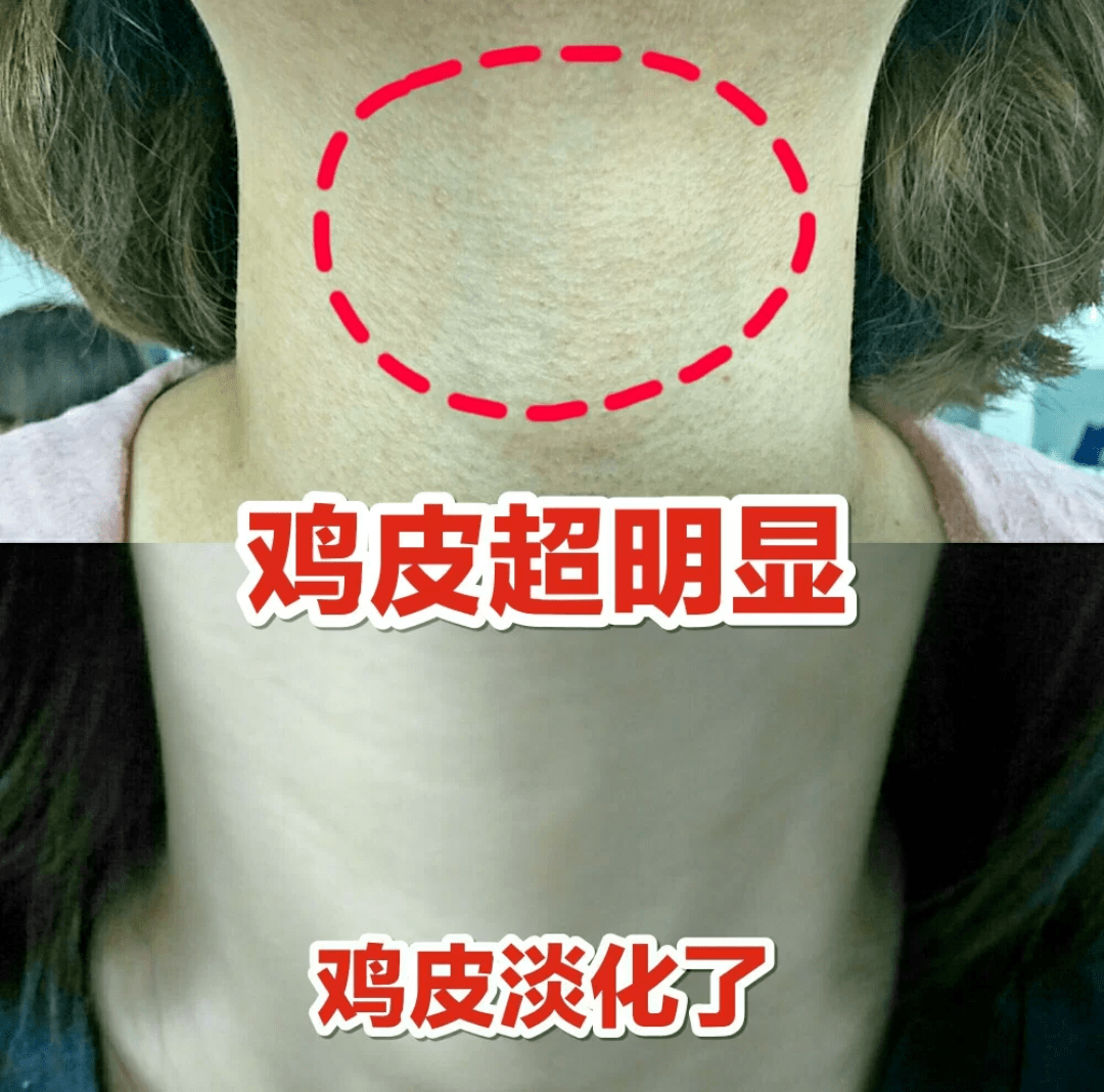 角质|薇娅吹爆的这款磨砂膏,我替你们试了,用完蚊子能在背上劈叉!