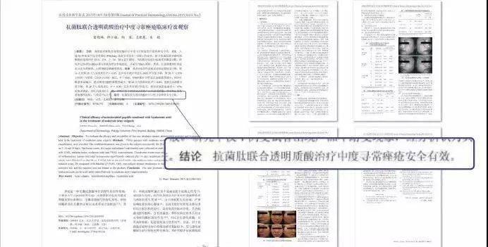 救星|这款PS级的“烂脸救星”，让我抛弃了SKII的“前男友面膜”！