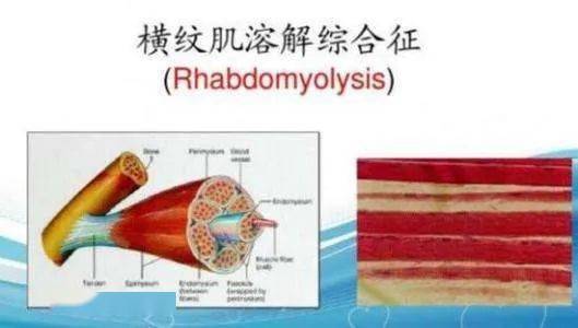 易普|竟跑进急诊室？易普| 吓坏！男孩日跑5公里