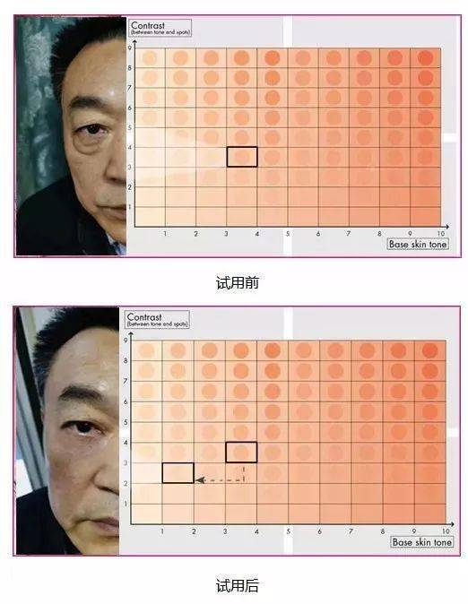 方法|眼袋显老又显丑，教你一方法轻松干掉它！！