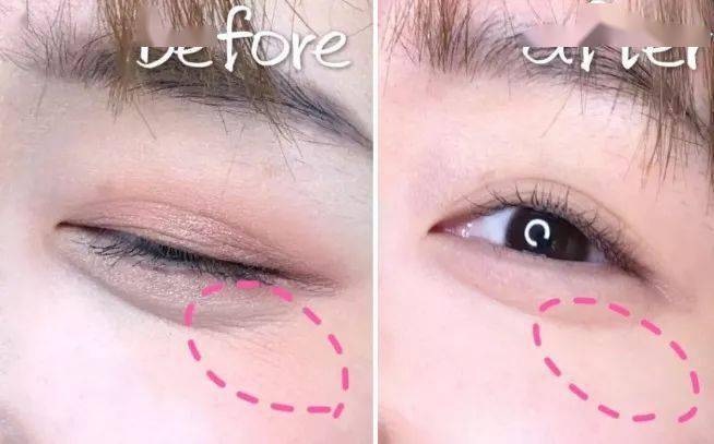 皱纹|抗皱抗衰老还在打针?用它赶走三八脸、鱼尾纹,让小朋友见到你都喊姐姐!