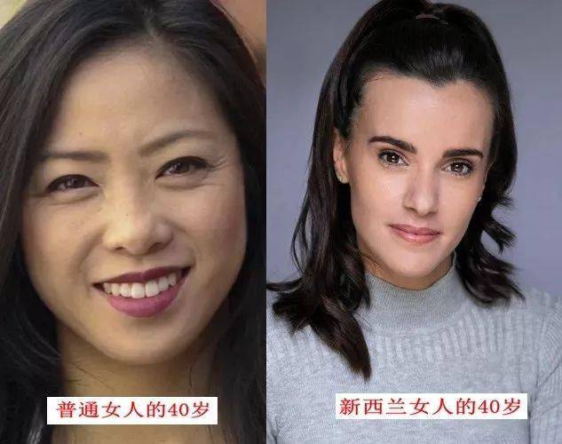 皱纹|抗皱抗衰老还在打针?用它赶走三八脸、鱼尾纹,让小朋友见到你都喊姐姐!