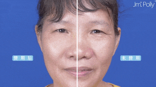 皱纹|抗皱抗衰老还在打针?用它赶走三八脸、鱼尾纹,让小朋友见到你都喊姐姐!