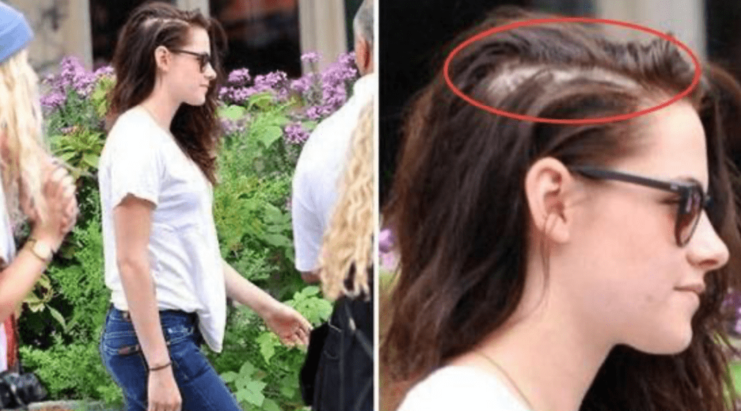 骄傲|守住发际线，是我最后的骄傲