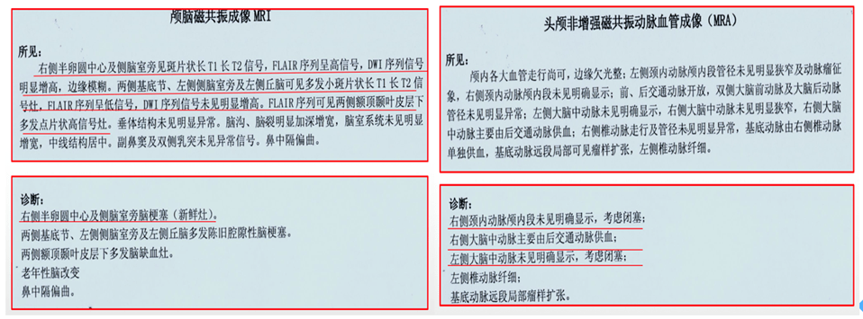 患者|cTNI最高达1.78ng/mL,一定是急性心梗吗?