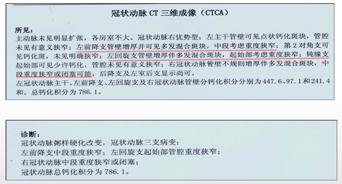 患者|cTNI最高达1.78ng/mL,一定是急性心梗吗?