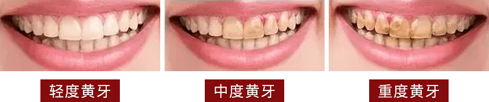 薇娅|林更新代言、薇娅打call的牙粉,买二送一,刷完牙白白的,说话都好香!