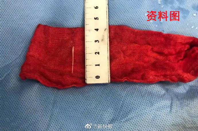 天后|广州男子鱼刺卡喉3天后呕血身亡 留下两个未成年的孩子