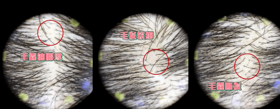 头发|大写的服！热巴居然连一根细小的发丝都不放过...