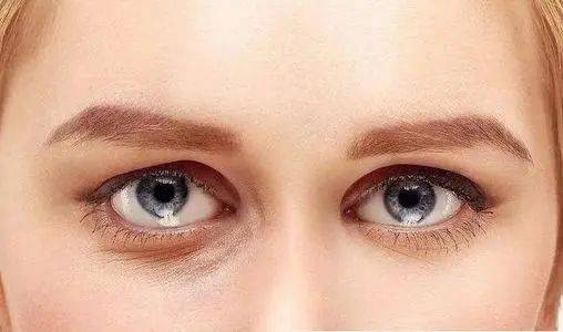 【眼袋】眼袋的形成原因有哪些_眼袋怎么消除