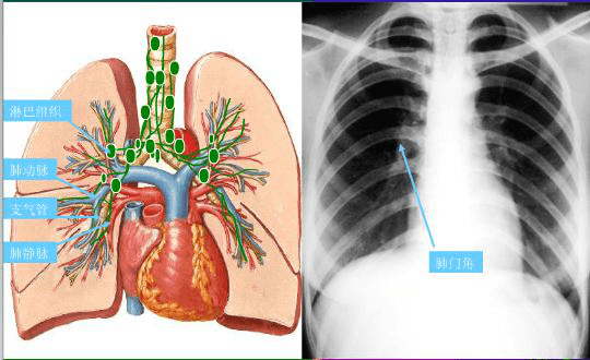 影像小白收藏:认识肺部影像结构!_纵隔