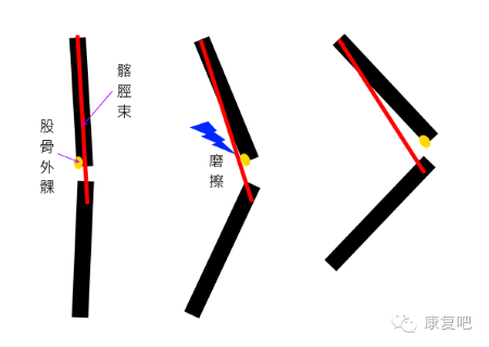 哪些东西可以摩擦起电 e7a042c1ddcd4a39bdc1827fe1830f50.png