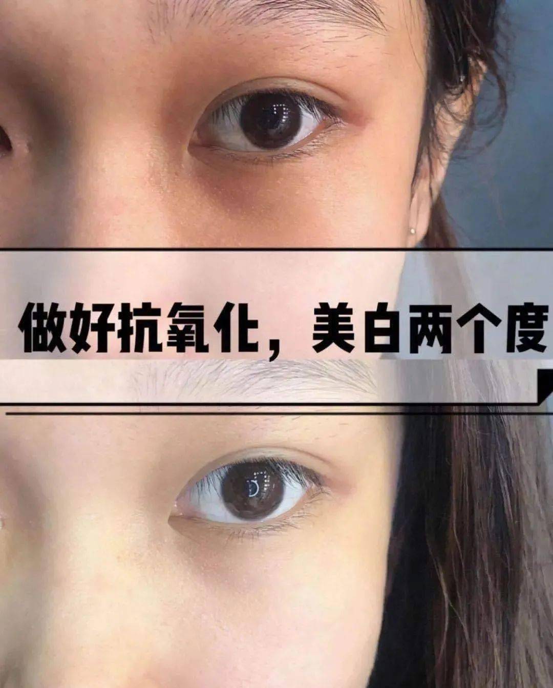 肌肤|40岁的年龄，18岁的脸，深扒“金喜善们”的冻龄术，竟然都是它！