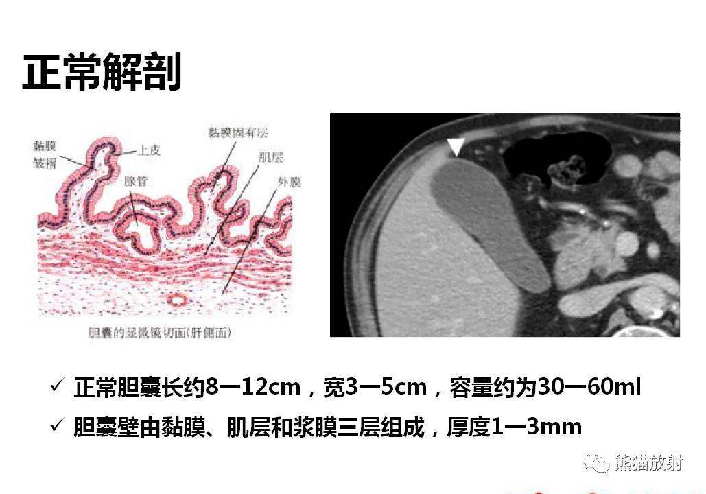 胆囊壁增厚性病变