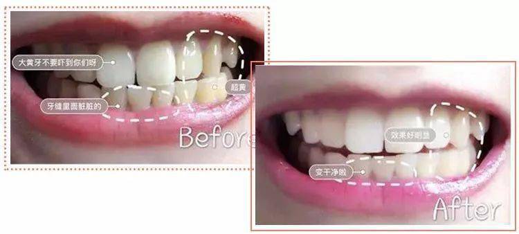 口腔|张嘴闭嘴还口臭？该怎么拯救？