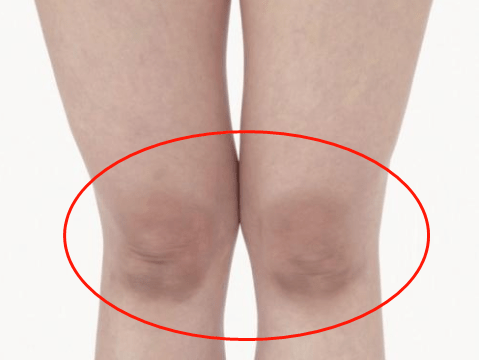 皮肤|白到发光的张雨绮性感冲出屏幕!这次成了“直女斩”