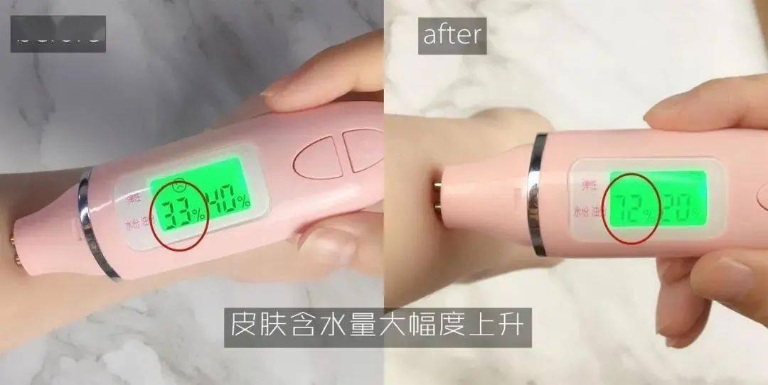 皮肤|白到发光的张雨绮性感冲出屏幕!这次成了“直女斩”