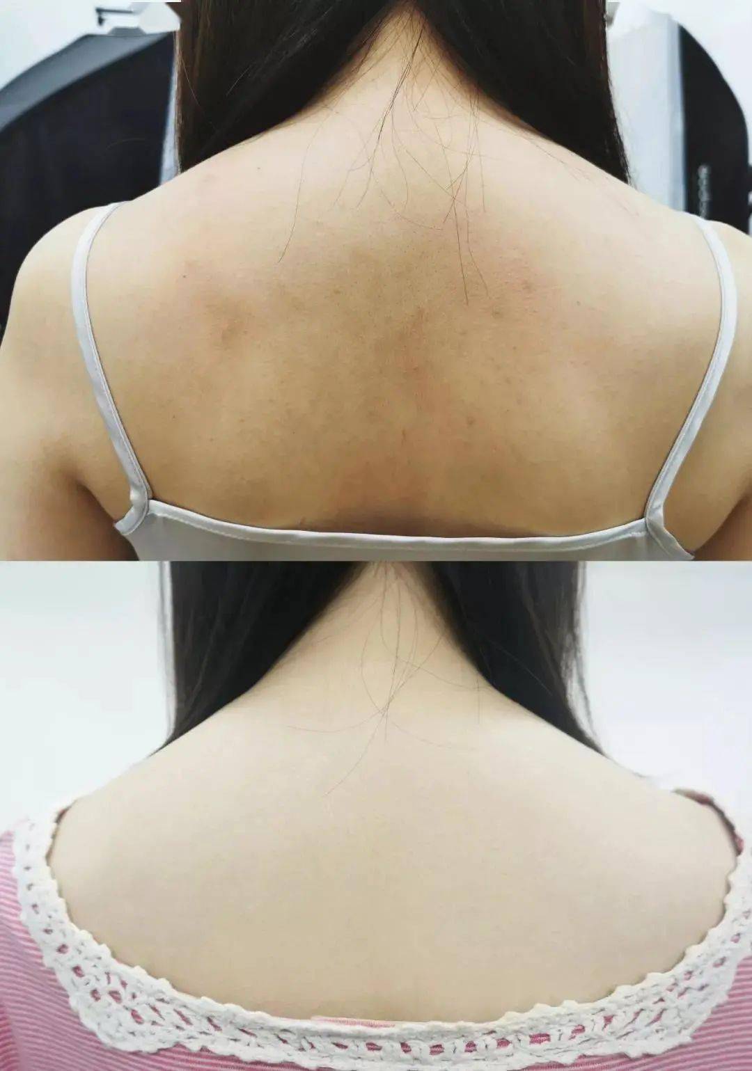 皮肤|白到发光的张雨绮性感冲出屏幕!这次成了“直女斩”