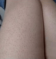 皮肤|白到发光的张雨绮性感冲出屏幕!这次成了“直女斩”