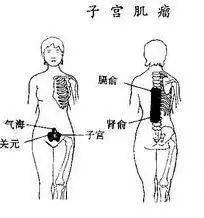 后背刮痧有什么原理么_刮痧图片后背(3)