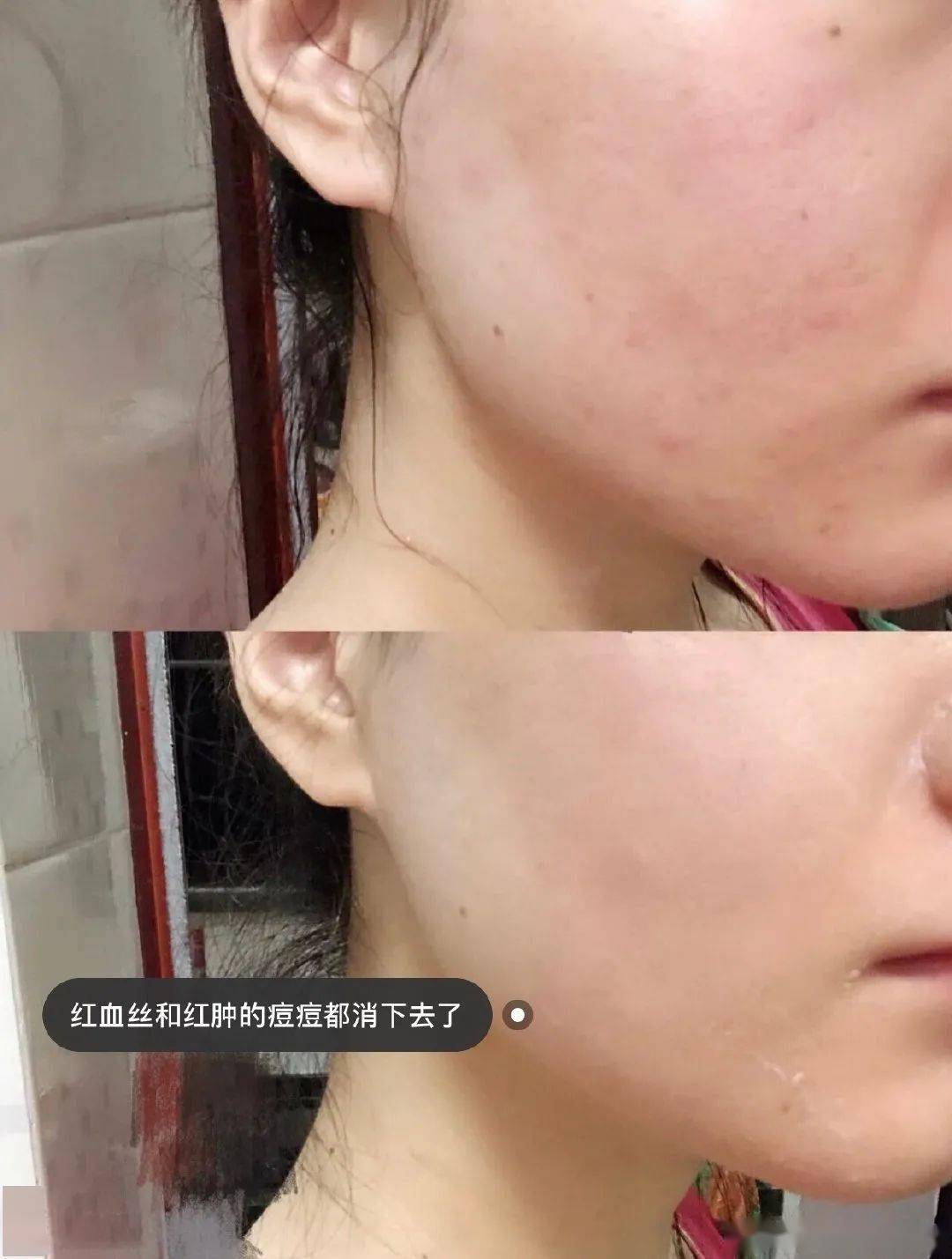 江疏影|江疏影真是白到发光了!她的好皮肤到底砸了多少钱?