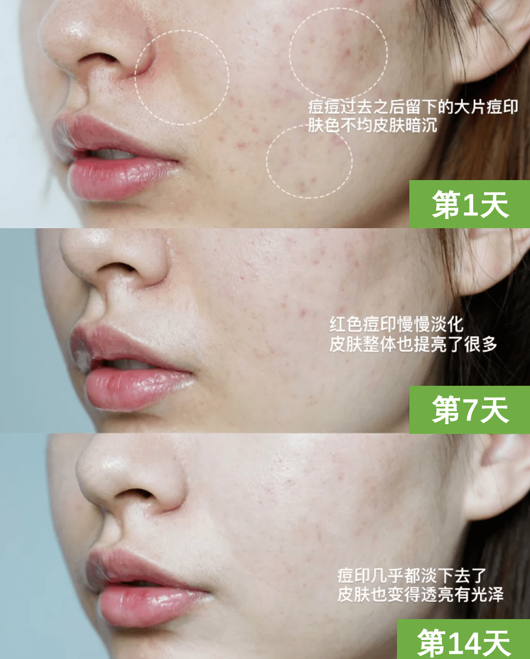 保养|张雨绮每月保养脸疑花70万，听了伊能静的金额……贫穷限制了我的想象