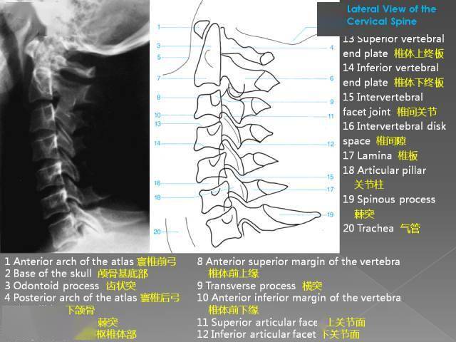 超详细的腰椎x线解剖及解读