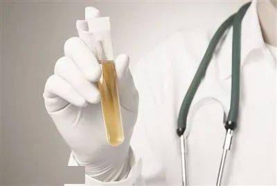 患者|盘点！中枢性尿崩症患者服用弥凝的5大经典误区