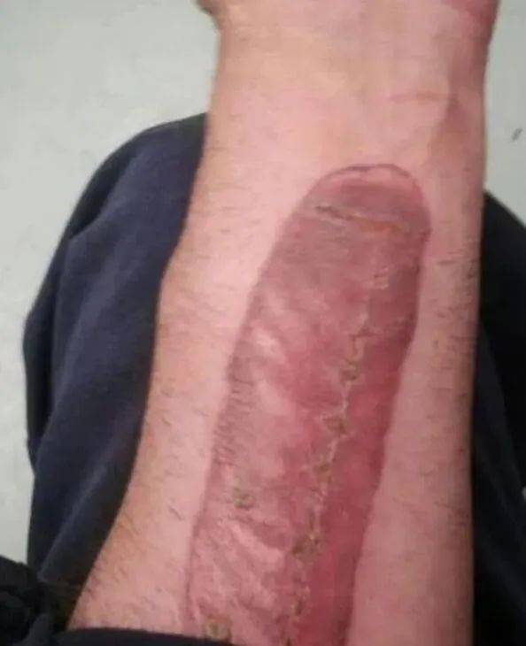 ‘xiongmao体育’
这纹身 算是白纹了 (图14)