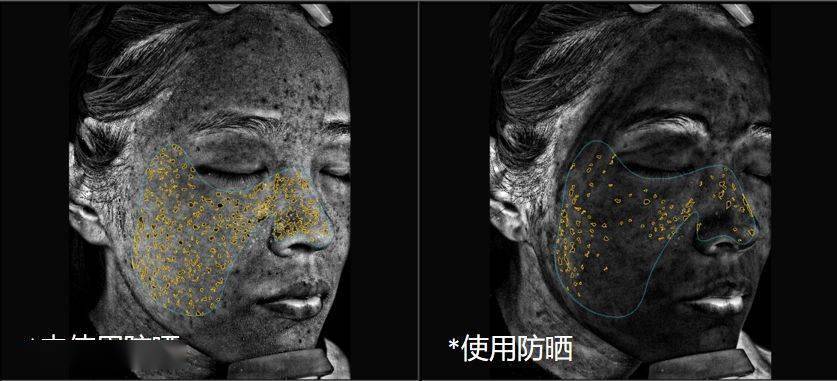 防晒力|“冯女郎”黑历史被扒？！被吹捧“高级”的钟楚曦，变美就靠这？