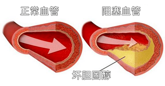 指标|宣医科普|一分钟看懂『三高』检查报告