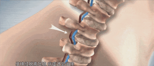 我的陈年颈椎病居然被这个怪东西给救了?妙啊!