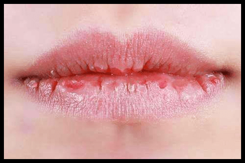 成语唇什么连_成语故事简笔画(5)