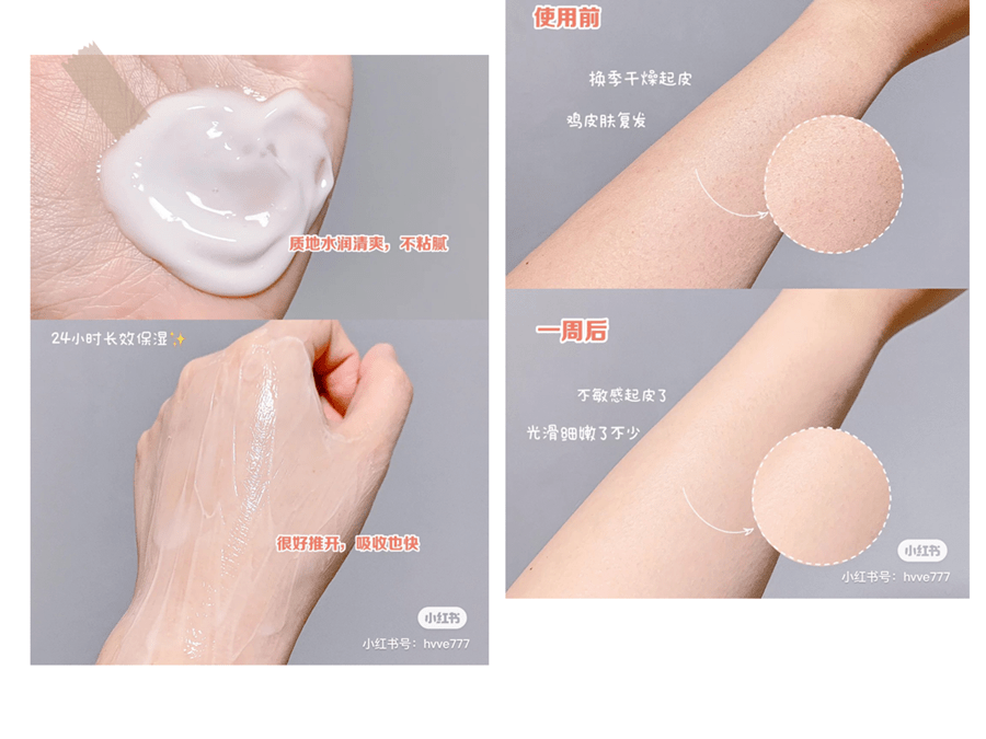 婆婆|皮肤干燥脱皮还起屑？是缺水还是皮肤病