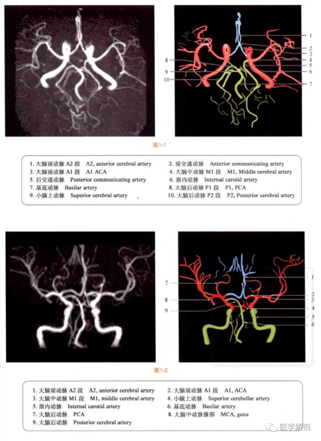 断层图谱mra磁共振血管造影对照解剖图谱