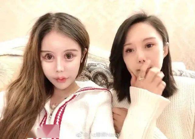畸形|“我花100万，把女儿整成了残废”：畸形审美毒害下，有20万女孩正在消失！