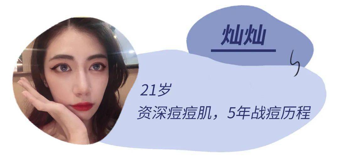 护肤|经常挤痘痘的女生，都是这个下场！（真人实测）